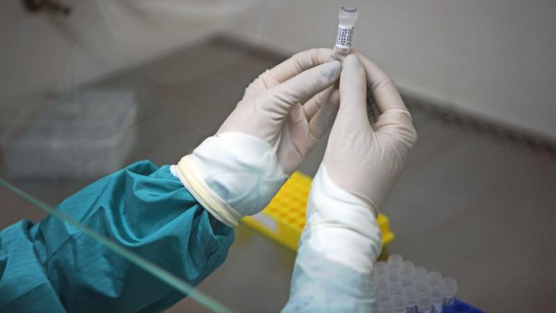 Analyst at Fiocruz laboratory in Rio de Janeiro in March 2020