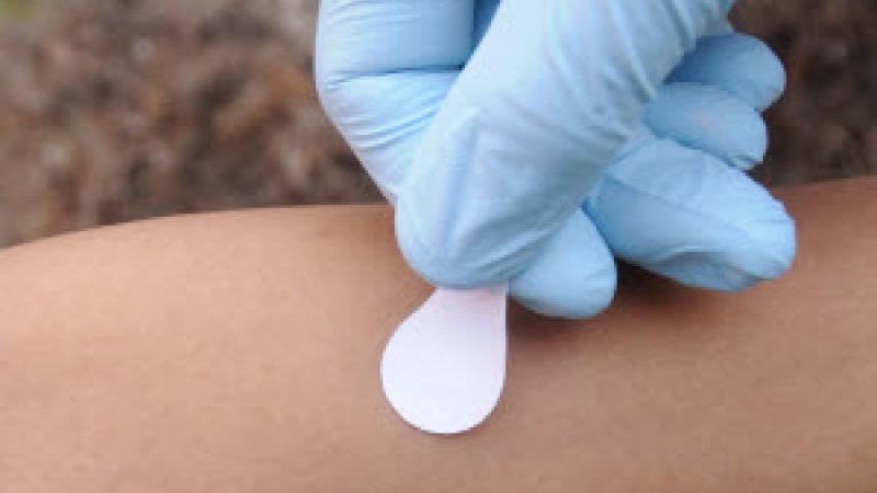 micro-needles vaccine patch