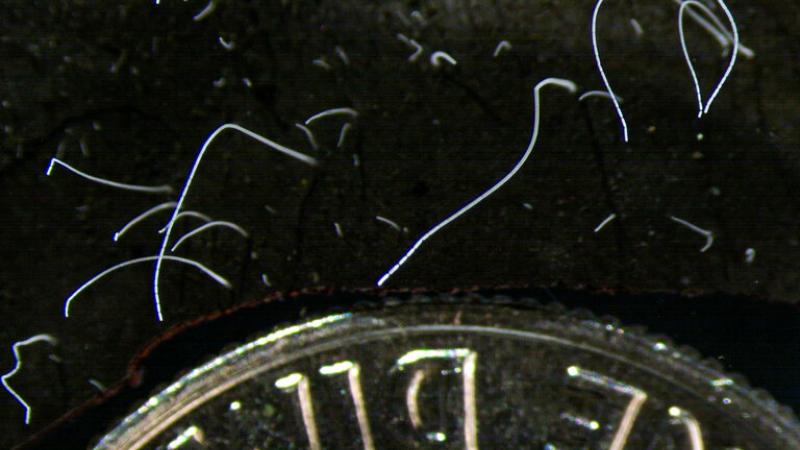 A photo of the bacteria