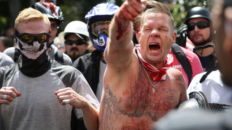 Anti-Trump protester