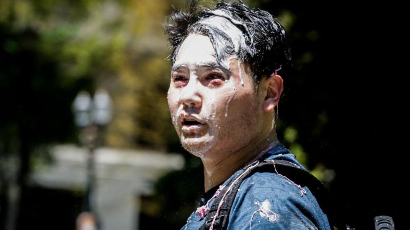 Portland journalist Andy Ngo after Antifa "milkshake" attack