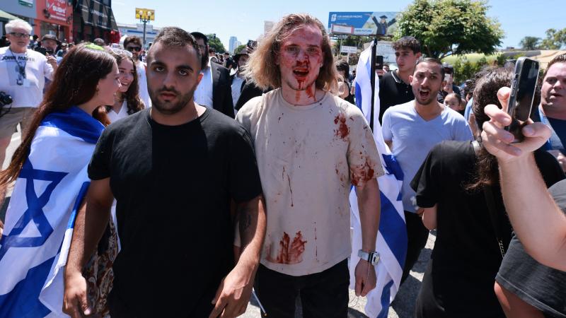 Israel supporter assaulted, Los Angeles, June 23, 2024