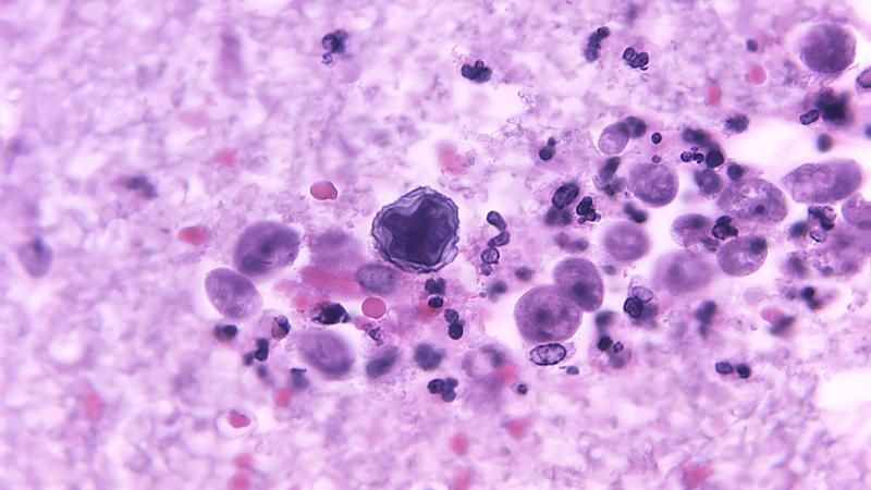 amoeba