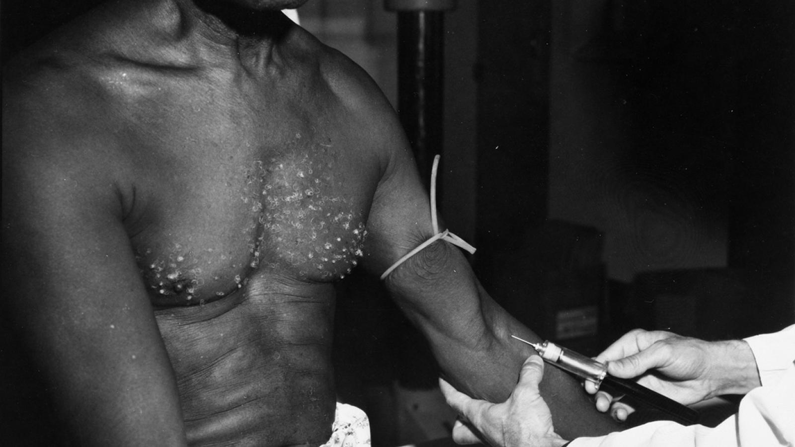 The U.S. government did syphilis experiments on African Americans without their consent