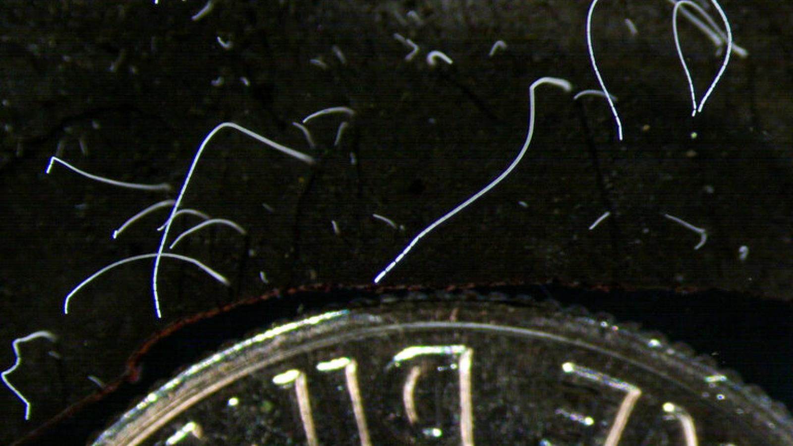 A photo of the bacteria