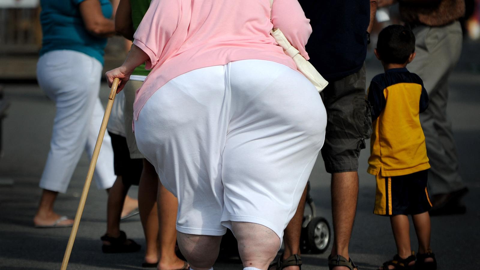 Obesity