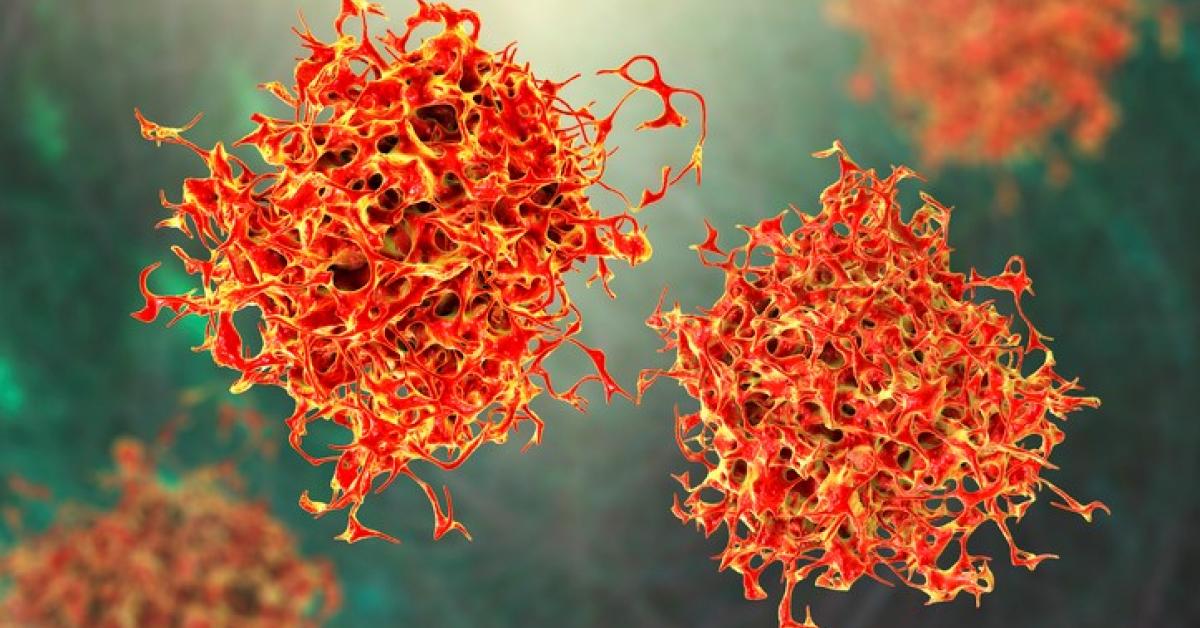 “Breakthrough FDA Approval: New Pancreatic Cancer Drug Boosts Survival Rates”
